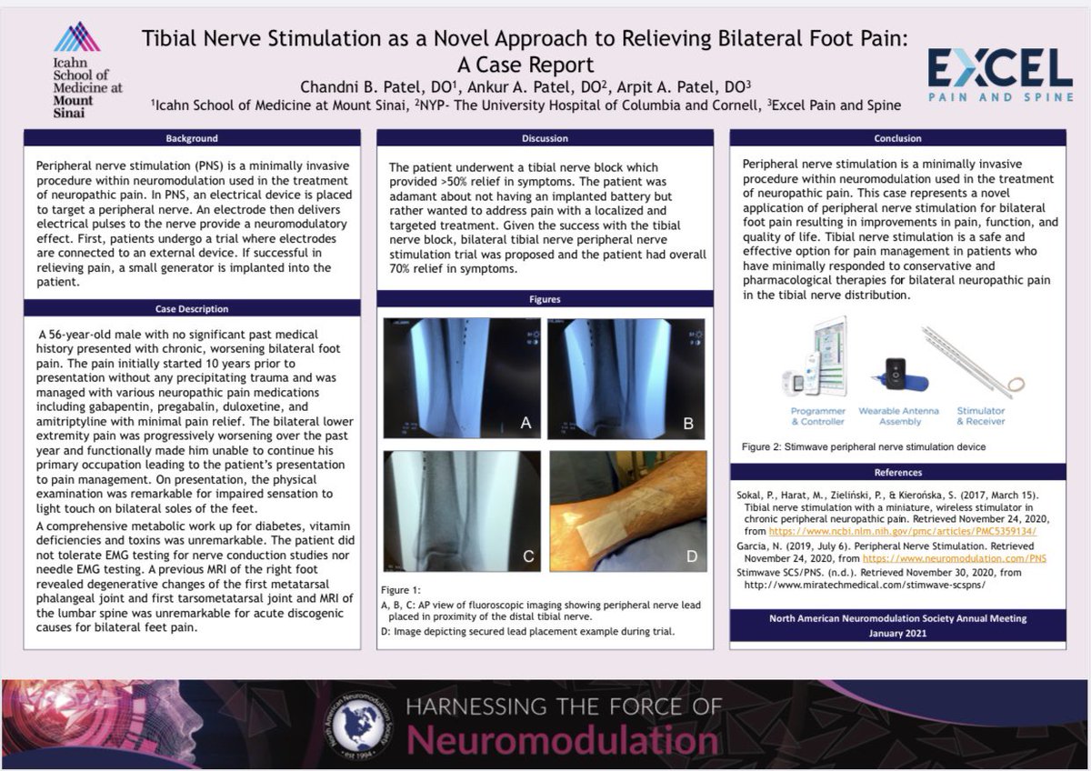 Dr_ChandniPatel's tweet photo. Excited to present this case on tibial nerve stimulation for foot pain at #NANS2021!

@NANS_ION @NANSRFS #NANSVirtual https://t.co/HrdvSKeWIW