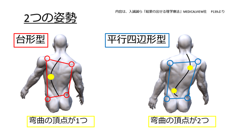 宮嶋 佑 分かりやすく伝える人 体幹の姿勢評価 前額面 体幹の姿勢変化は 台形型 と 平行四辺形型 に分かれる 台形型 同側の骨盤挙上と肩甲骨下制位 脊柱の湾曲の頂点は１つ 平行四辺形型 腸骨稜と肩甲骨が平行で移動した姿勢 脊柱の湾曲の頂点は