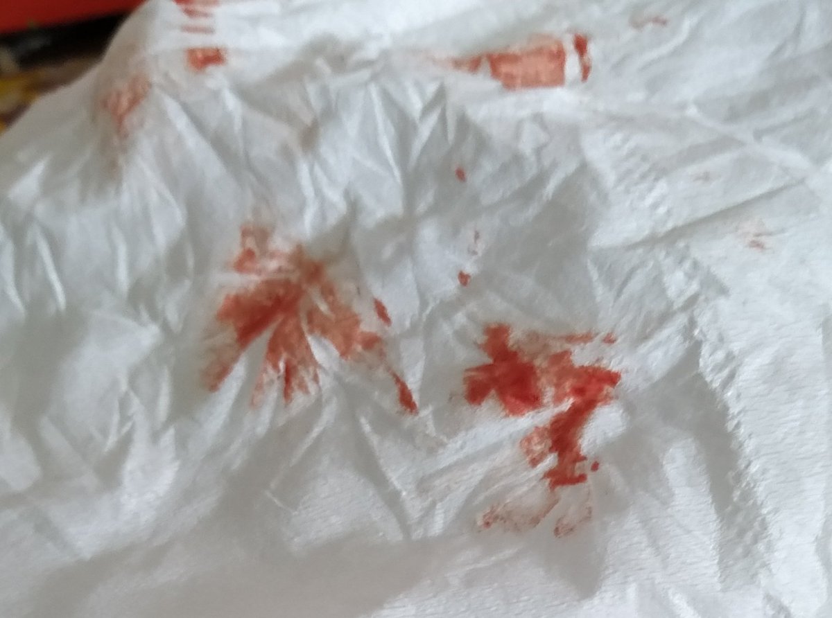 JalanDalam's tweet image. waduh pagi2 mimisan...kok jd dagdigdug...#sehat #waswas