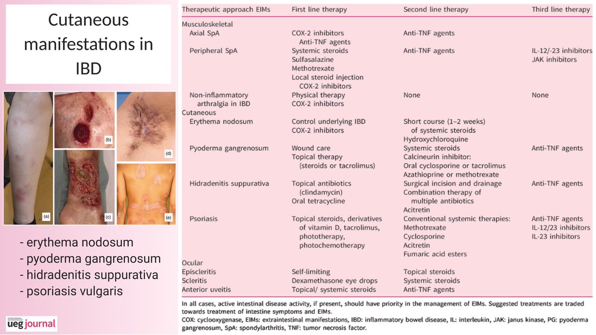 📌 Cutaneous manifestations in IBD 🔸 types 🔸 lines of therapy 💊 #IBD ...