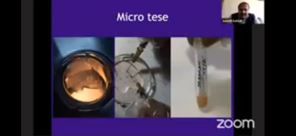 SonamSimpatwar's tweet image. Amazing lecture on IVF@niru22 #highgrad #ART #IVFcourse #sciencematters