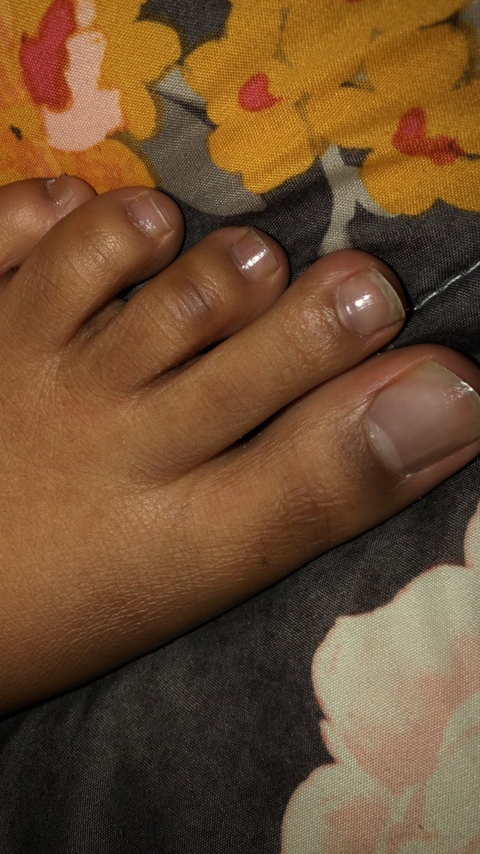 WorldWideFeet's tweet photo. Here’s a sneak peek #Feet #feetforsale #feetseller #sellingfeet #feepics #feetography #feetbabyOG

@FeetbabyOg https://t.co/GfWgaiJFlT