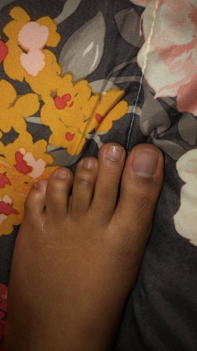 WorldWideFeet's tweet photo. Here’s a sneak peek #Feet #feetforsale #feetseller #sellingfeet #feepics #feetography #feetbabyOG

@FeetbabyOg https://t.co/GfWgaiJFlT