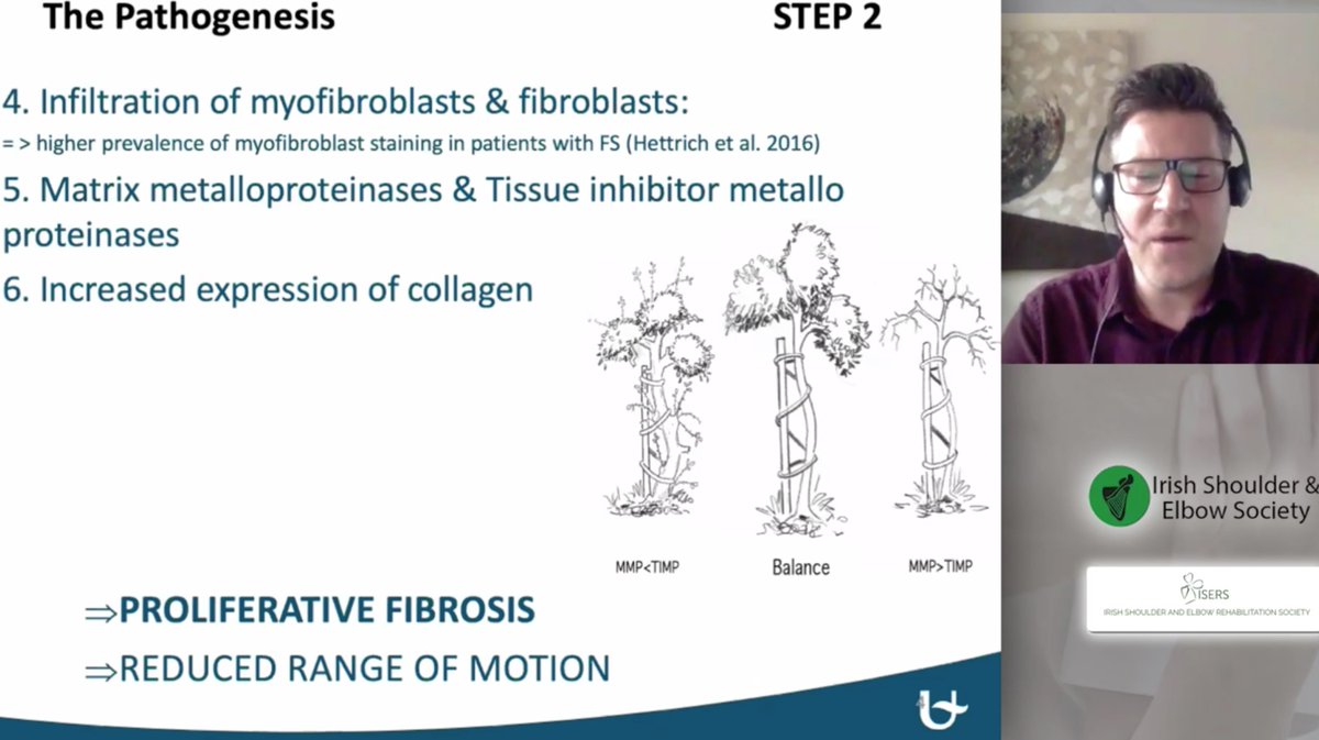 2) This is perhaps my favourite slide from the day. In the early painful stage of Frozen Shoulder provocative stretching may increase myofibroblasts thus INCREASING restriction.