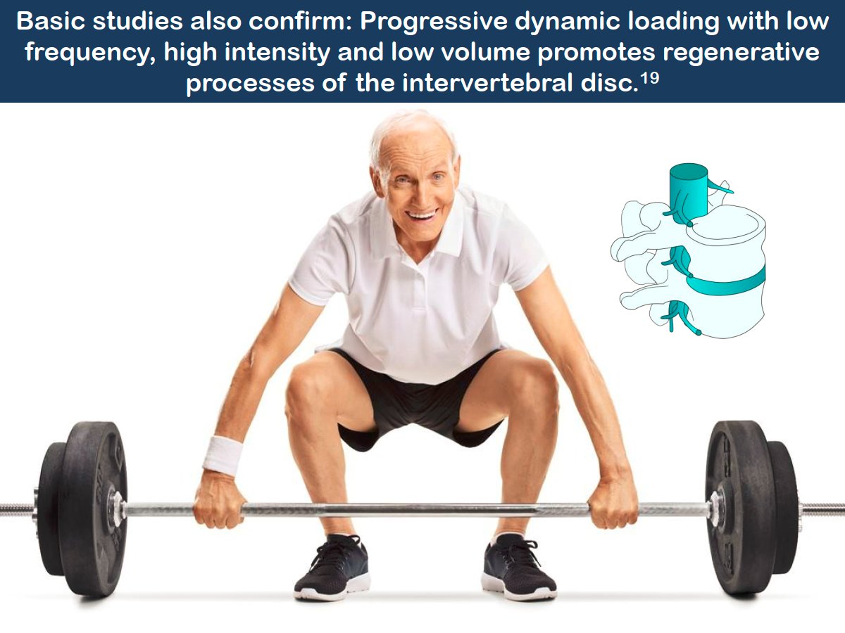 Load and intervertebral discs:Friend or foe?