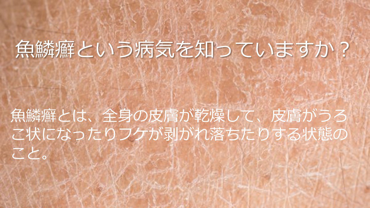 魚鱗癬 Twitter Bilaketa Twitter