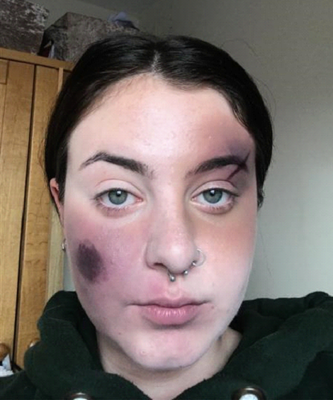 WiltsColl's tweet photo. ⚠️Warning – not for the faint hearted!⚠️
Here’s our Media Make-up students’ work for their unit based on the brief ‘trauma’, created at home using their kits!
Find out more about our Hair and Beauty courses: https://t.co/fZgFQdvuTK
#wearewiltshire #wiltscoll #mediamakeup https://t.co/ZS5Y2XBd6c