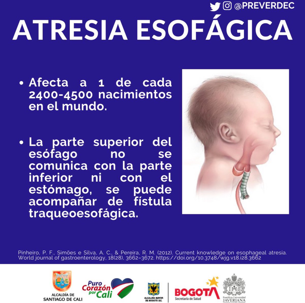 NoInvisibles's tweet photo. Enero es Mes de concientización de la Atresia de Esófago #AE
Los niños nacidos sin poder comer necesitan al menos una cirugía para lograrlo.
#atresiadeesofago #atresiaesofagica #EPOF #EERR
Conoce más👇en @ATEARorg
https://t.co/ceDhXMfye3
Tipos de #AE👇pre https://t.co/7TU6M6KD9m