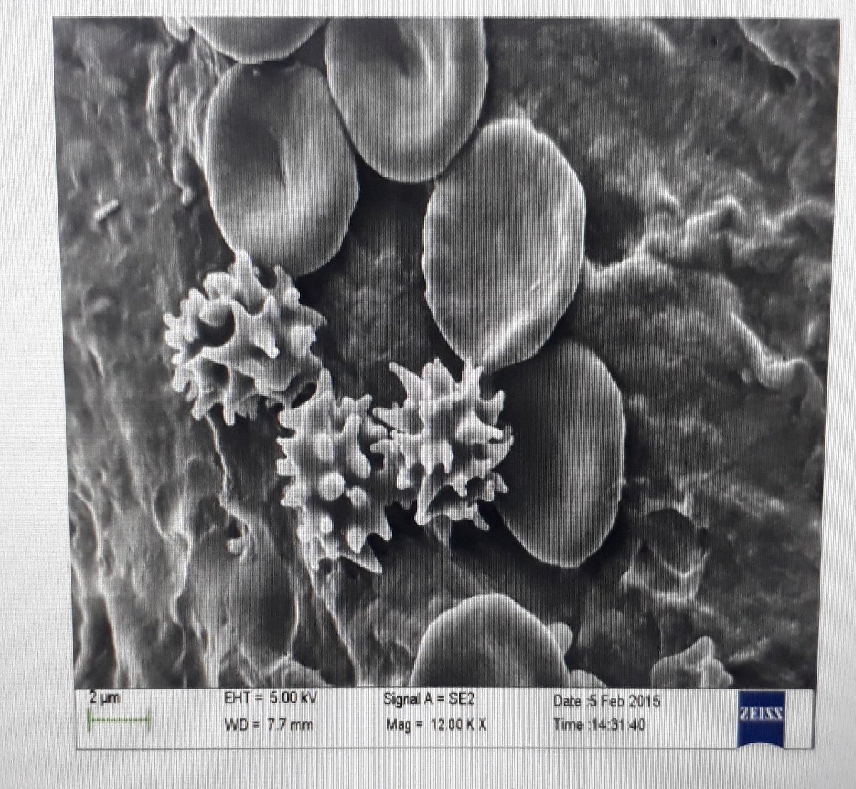Kavisa9's tweet photo. One of my favorite SEM images... Effect of toxic material on erythrocytes (in vivo work)... causing... Echinocytosis (Image from my publication) #Science #SEMImage #SEM https://t.co/6K0NITIOJ7