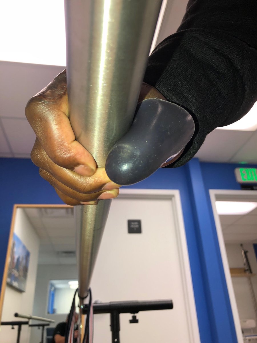 MedicalCenterOP's tweet photo. For this client, our team custom made a rolled silicone thumb protector to help reduce the nerve pain and trauma to the end of his thumb - and the result turned out great!
#adaptive #iamadaptive #amplife #amputeelife #overcome #moveforward #moveforwardMCOP #MCOP #amputeestrong https://t.co/iX1OwXUWp1