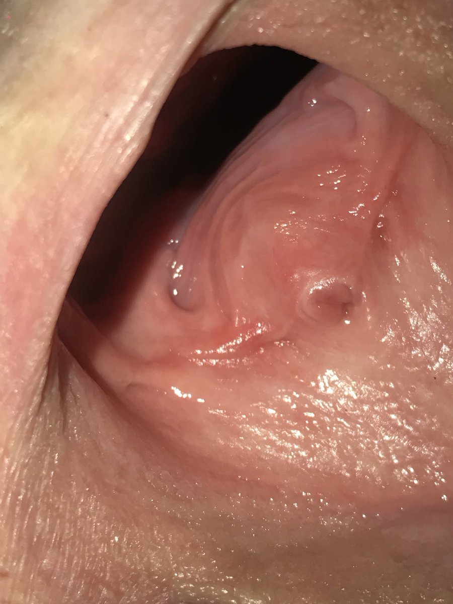 Stuffedpussylo1's tweet photo. This is how her pussy looks after wearing a massive plug the whole day #gapinghole https://t.co/2w1gHMWRIQ