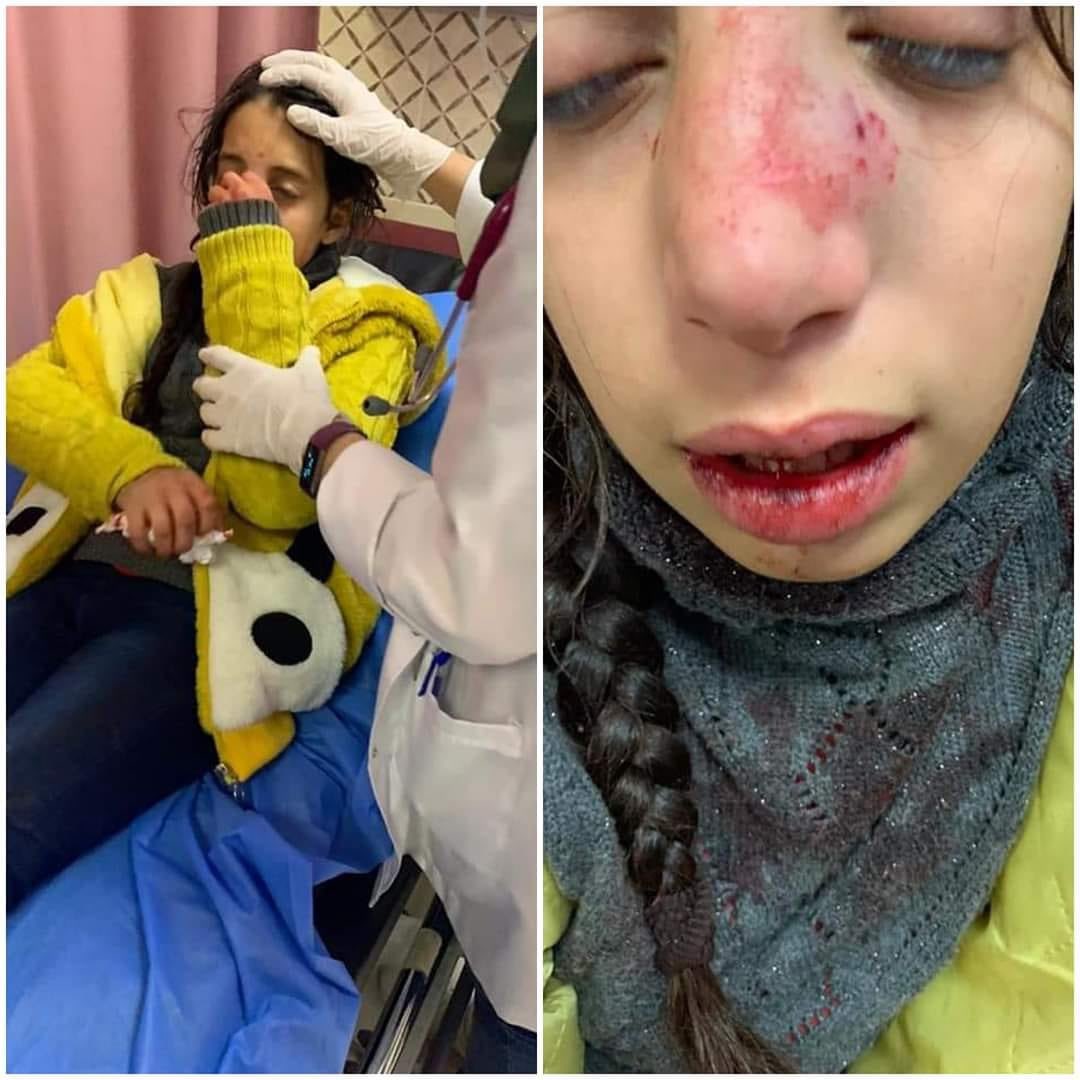 michelegiorgio2's tweet photo. L'agenzia Wafa riferisce del ferimento di una bambina palestinese di 11 anni, Hala Mashhour Qutt, colpita alla testa da una pietra durante un raid di coloni israeliani nel suo villaggio Madama (Nablus). https://t.co/1Wo0ozVjLr