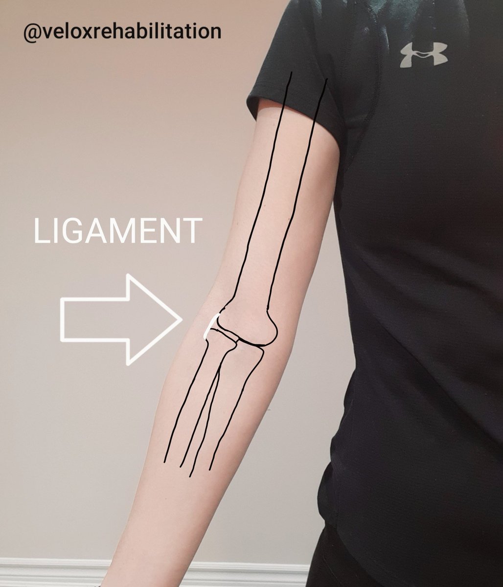 vrogovskyPT's tweet photo. 1) Tendon
Attaches the muscle to the bone. It serves to move a structure.

2) Ligament
It attaches bone to bone. It serves to keep structures stable.
#physiotherapist #physiotherapy #vaughan #vaughanphysiotherapist #physio  #vaughanphysiotherapy #woodbridge #maple #thornhill https://t.co/uLwGZRN7xn