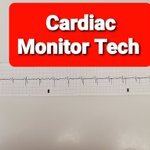 Photo by Cardiac Monitor Tech (@cardiacmonitor)