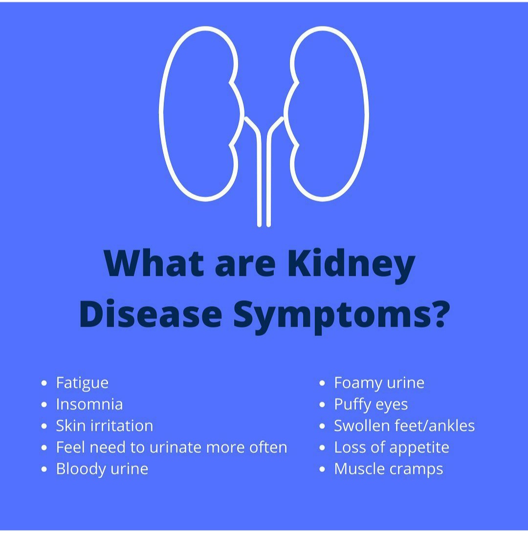 Jessie's had a rough week. No energy,no appetite,insomnia and can't make it through the day without a nap.Leg cramps keep her up most of the night. 
Back to Hamilton next week for some labs.
#kidneyforjessie 
#organdonorssavelives