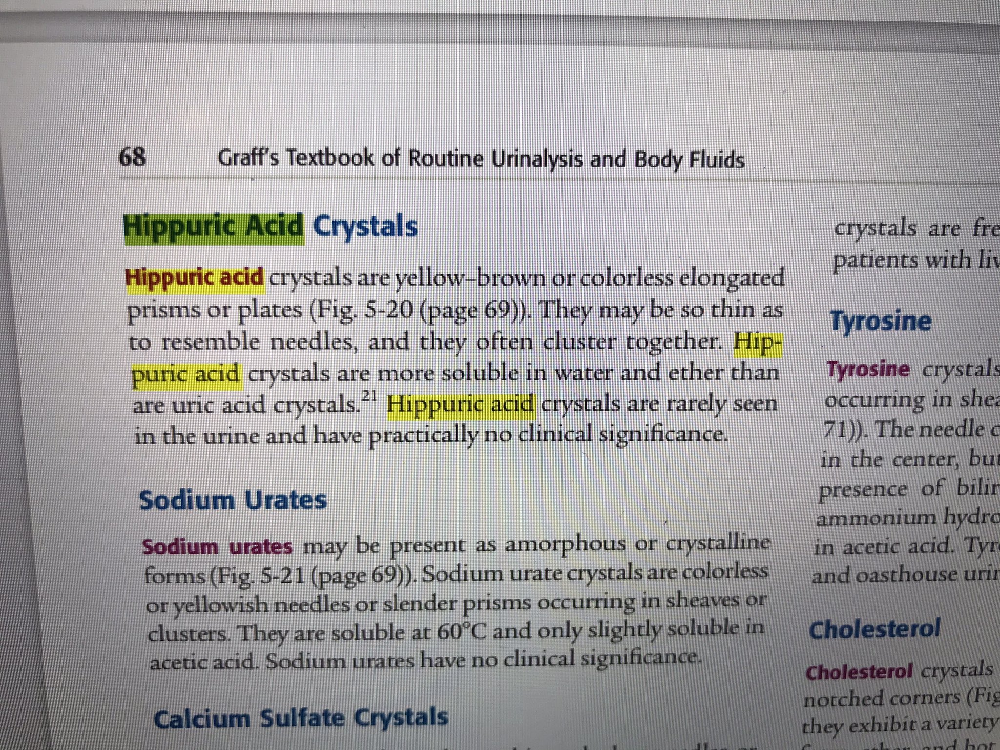 sodium urate in urine