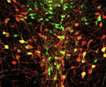 ecalixto's tweet photo. La SOLEDAD afecta la actividad de la red neuronal por defecto, la cual se centra en pensamientos internos, como recuerdos, divagaciones y ensoñaciones, estar solo obliga a utilizar más la imaginación y fantasías. 

#NocheNeuroTuits
Spreng et al., 2020, Nature Commun; 11: 6393. https://t.co/ojTqzKnZre