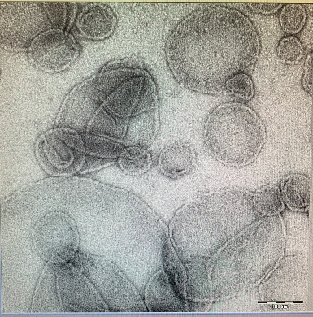 Tina_R_Matin's tweet image. Done! While the winner is on the right, you know which one has my ❤️ 
#biophysics #electronmicroscopy #TransmissionElectronMicroscopy #JOEL #NegativeStaining #microscopy #proteoliposomes @ScheuringLab