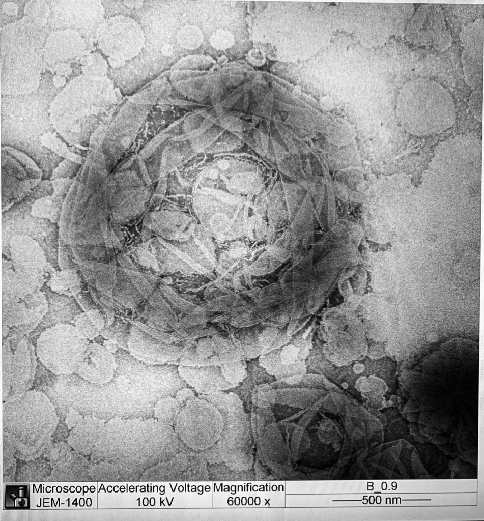 Tina_R_Matin's tweet image. Done! While the winner is on the right, you know which one has my ❤️ 
#biophysics #electronmicroscopy #TransmissionElectronMicroscopy #JOEL #NegativeStaining #microscopy #proteoliposomes @ScheuringLab