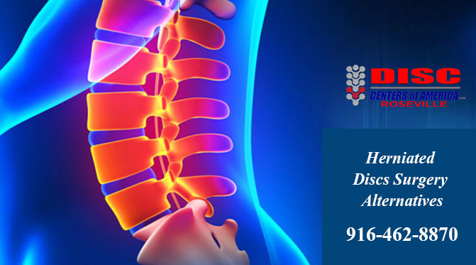 #HerniatedDiscsSurgeryAlternatives For more details, visit here: bit.ly/3pSU3W6