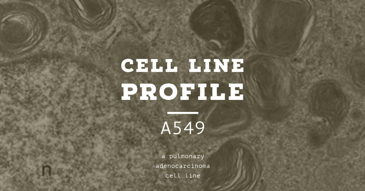 ECACC's tweet photo. The #A549 #cellline was isolated in 1973 from a pulmonary adenocarcinoma in a study to attempt to establish continuous cell lines from 200 different tumours. Find out more from our #celllineprofiles https://t.co/pPPgZdz2Ep https://t.co/lSgUVJLABT