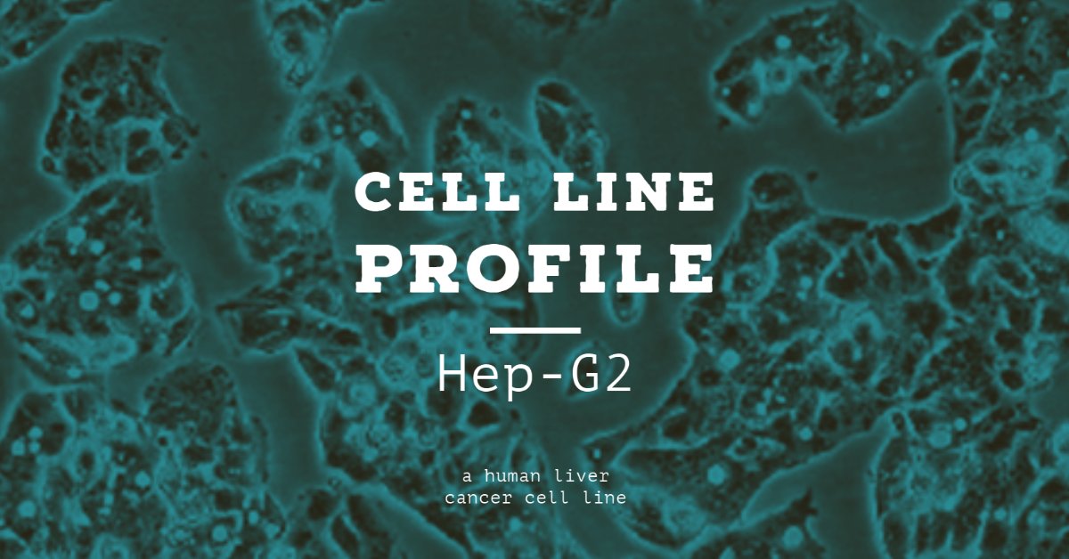 ECACC's tweet photo. Hep-G2 is a human #livercancer #cellline that was derived from the liver tissue of a 15yr old Caucasian male with a hepatocellular carcinoma. Find out more from our #celllineprofiles https://t.co/pPPgZdz2Ep https://t.co/UOzrN48wfe