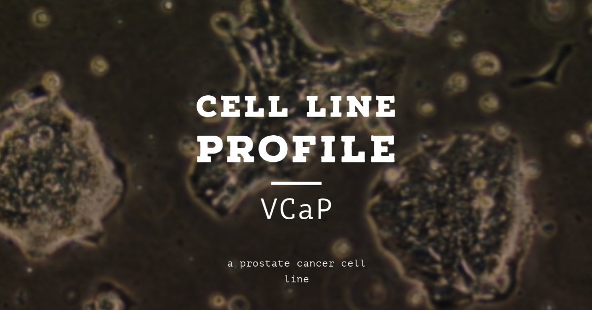 ECACC's tweet photo. This Vertebral-Cancer of the Prostate (VCaP) #cellline was established in 1997 from #ProstateCancer tissue harvested from the body of a patient with hormone refractory prostate cancer. Find out more from our #celllineprofiles https://t.co/pPPgZdz2Ep https://t.co/LVJVCMg4Q0