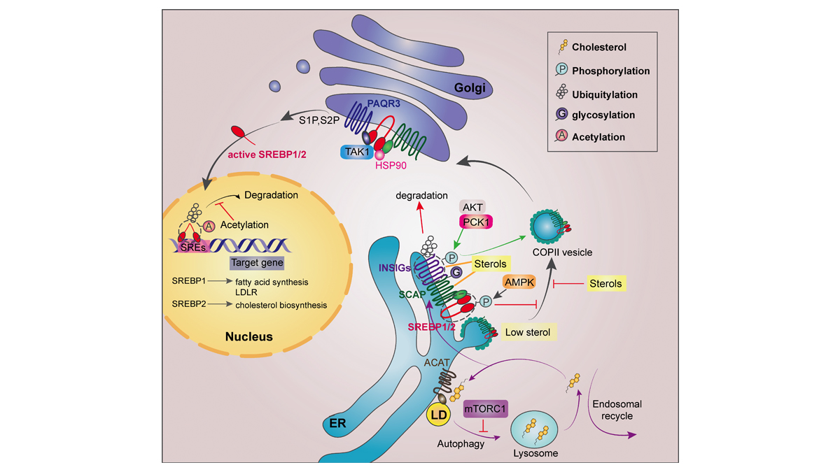 JExpMed's tweet photo. In this #JEMCancerFocus review, Xueli Bian, Zhimin Lu @ZJU_China, et al. discuss the current understanding of #lipid #metabolism in #cancer cells and introduce various approaches that have been clinically used to disrupt lipid metabolism in cancer therapy. https://t.co/ehfUn9of8P https://t.co/4cGZYkSNj3