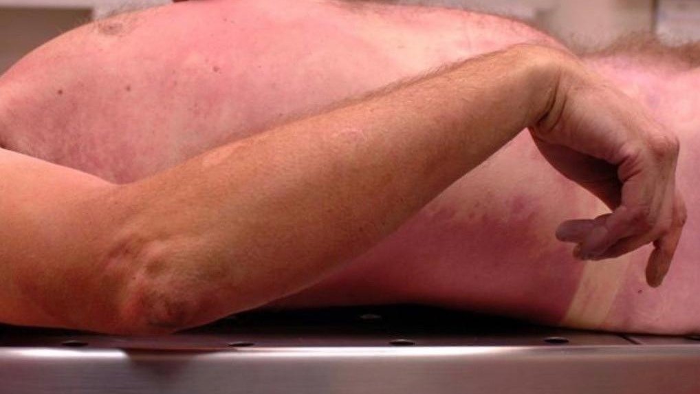 Rigor mortis: - stiffness of the muscles - occurs 1 to 2 hours or max. 12 h after death - starts in small muscles of the face followed by hand, arms  and then legs and trunk- disappears from the deceased person after almost 3 to 4 days