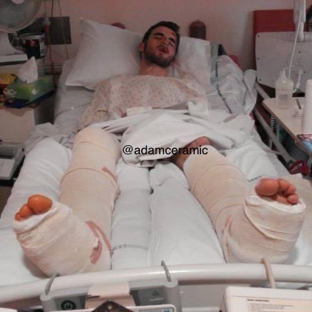 Over 10 years ago  @AdamCeramic was knocked down by a car that drove away. He was in a coma and left in a wheelchair to recover. He is mostly fine now (he can’t remember what he has forgotten!)