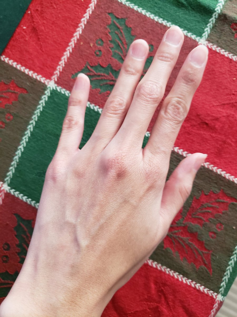 msvanitylang's tweet image. Impromptu hand pics. Happy Wednesday all! 😄

#handpics #handmodeling #LHKhands #LiuHaikuanhands #femhaikuangegehands