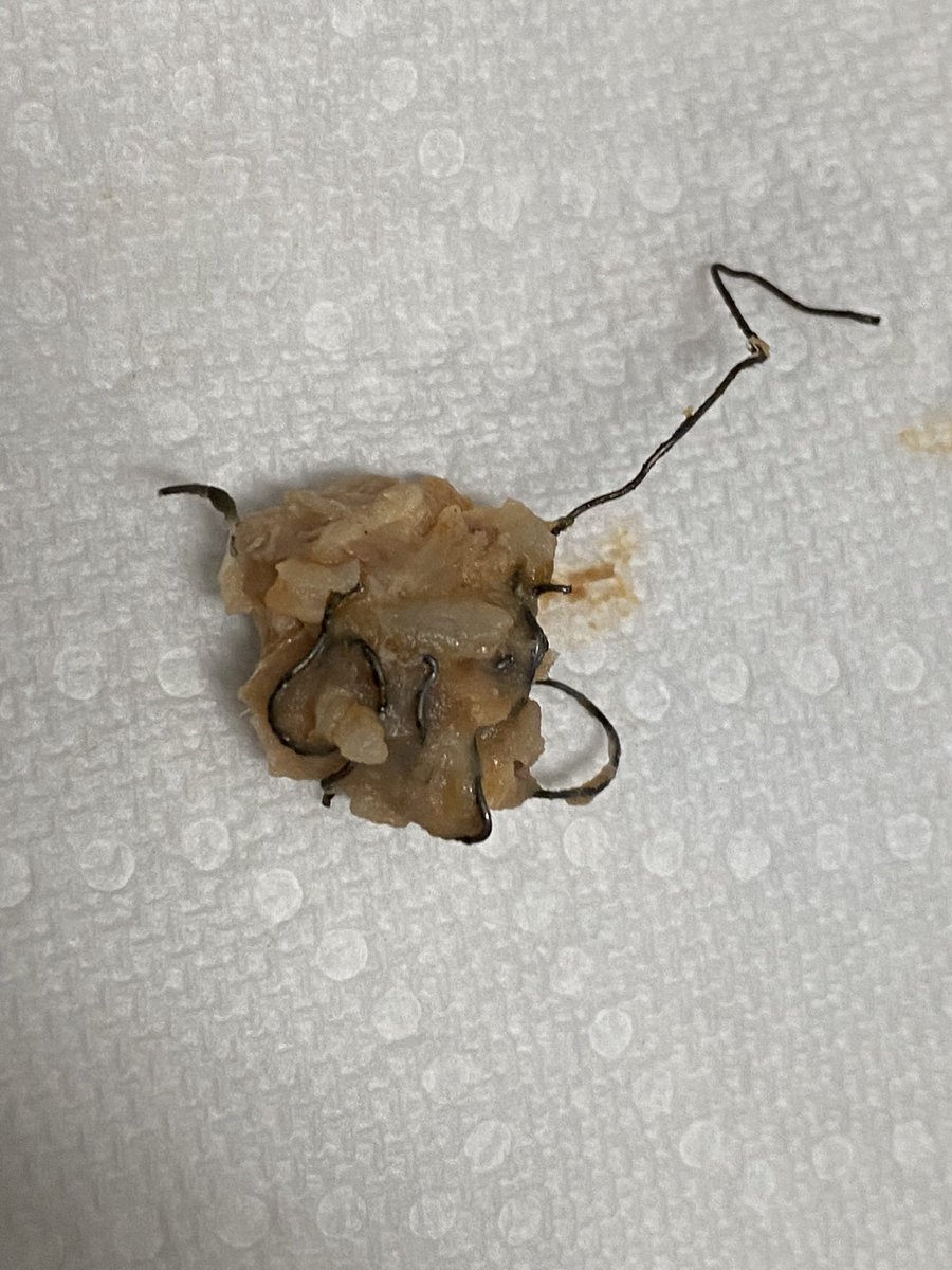 MiMi_Marie's tweet photo. Received a less than appropriate response from management at Fiesta Mexicana Hixson when I informed them we nearly ate the balled up wire found in our food. Was rudely informed they “do not use those kinds of wires” and implied I put it there. Never again will I eat here. https://t.co/3sPi1dBu0Z