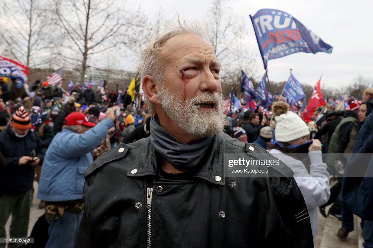 A man bleeding from the eye stands outside the #USCapitol after a pro-Trump mob breached the building during a joint session of #Congress on January 6th in #Washington DC 📷: @tasosphotos #CapitolBuilding