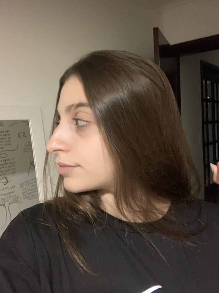 mwndstef's tweet photo. antes e depois da minha rinoplastia, me sinto uma nova mulher https://t.co/ZhUTuHkg87