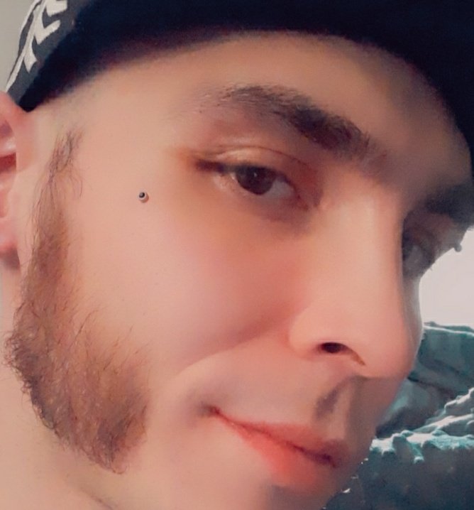 DarkMatterSad's tweet photo. got a new piercing! I'm in love with it omg :o #dermal https://t.co/DgkqQkKJmp