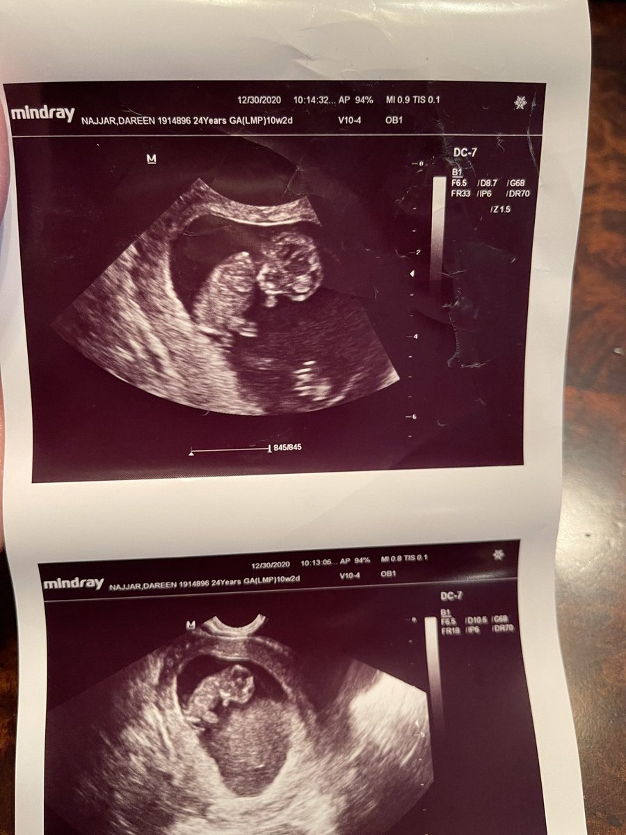 Our family just got a little bigger 🙏🏽 Another blessing is gonna be entering our lives this year. Words can’t describe how happy I am 😭. I love my family and I can’t wait for this next little beauty 💕  #GirlDadLife #DaddysLittleGirls #ZaraGotALittleSister