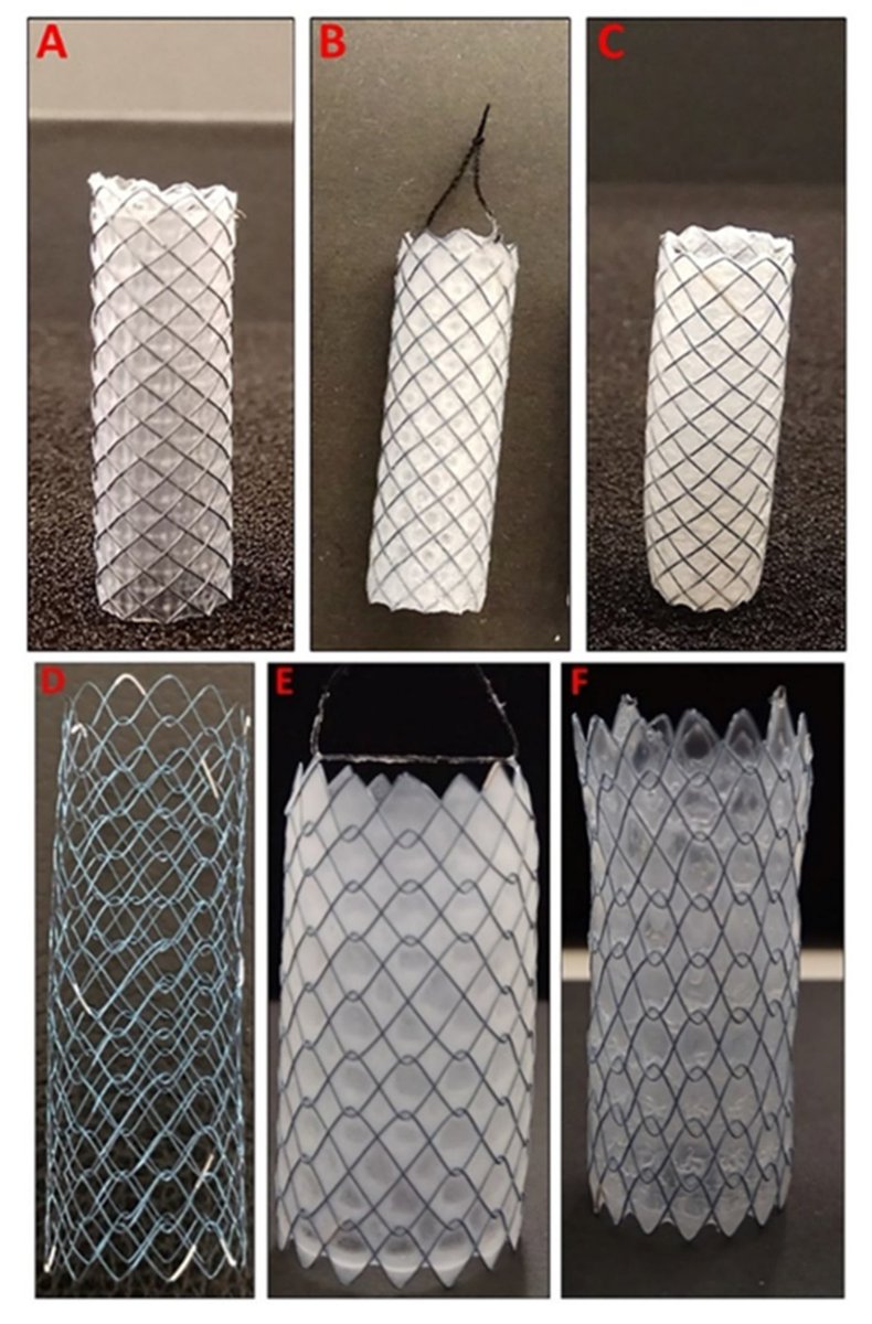 MDPIpharma's tweet photo. #MDPIPharmaceutics "Development and In Vitro Evaluation of 5-Fluorouracil-Eluting Stents for the Treatment of #ColorectalCancer and Cancer-Related #Obstruction", a research article by Mohammad Arafat et al.
Full paper: https://t.co/ymnsi0QMD3
#GastrointestinalCancer #DipCoating https://t.co/vj0Ek99y6v
