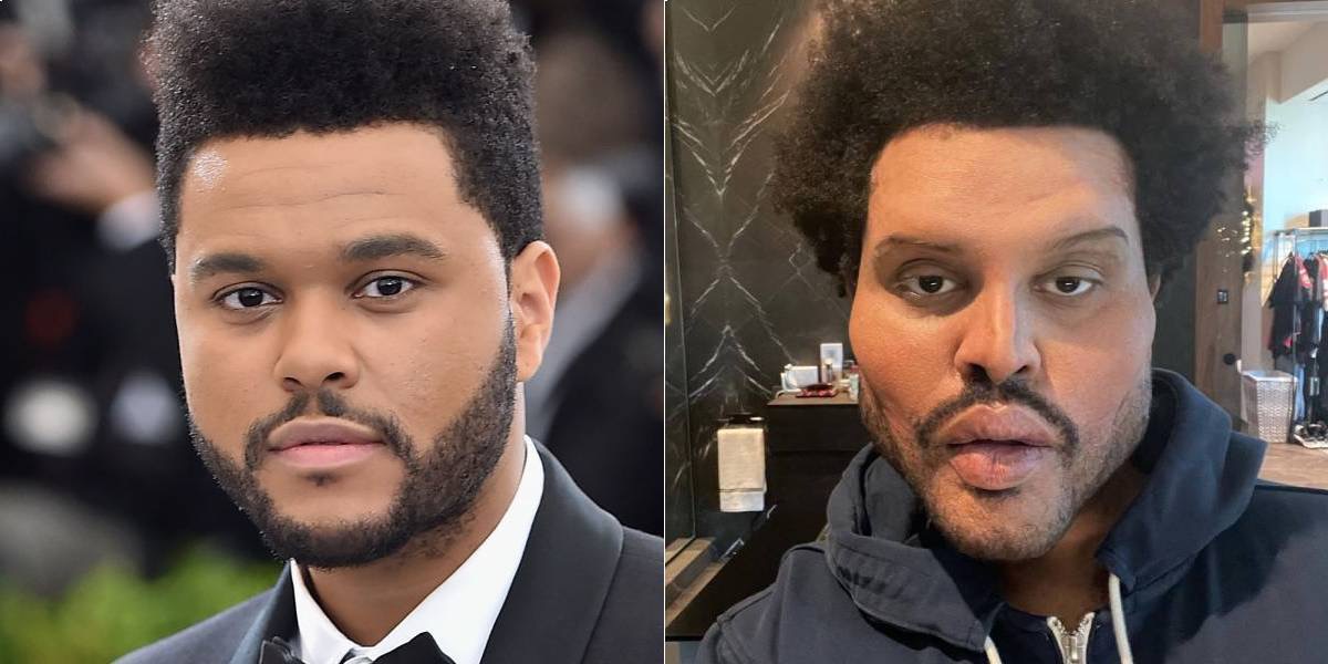 Elle Japan على تويتر ザ ウィークエンドが整形 尖った鼻と膨れた頬にファン震撼 T Co Djhxdpzl6f