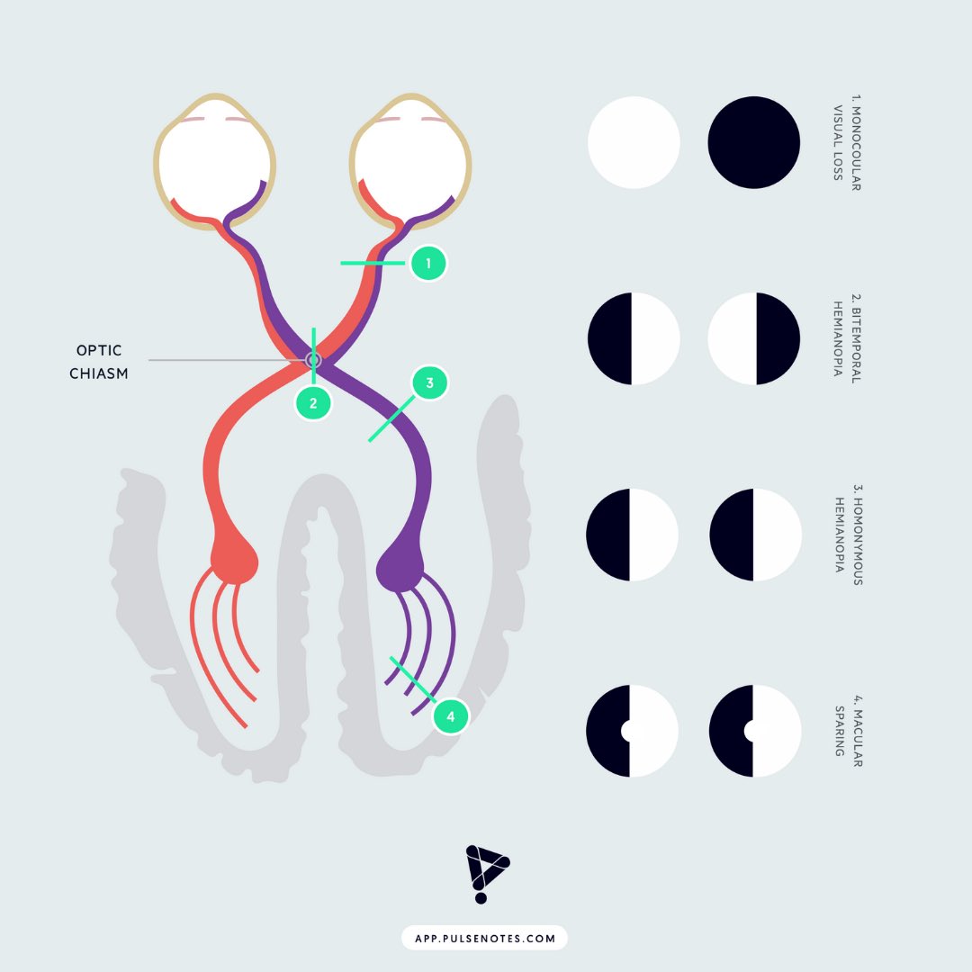 Pulsenotes tweet media