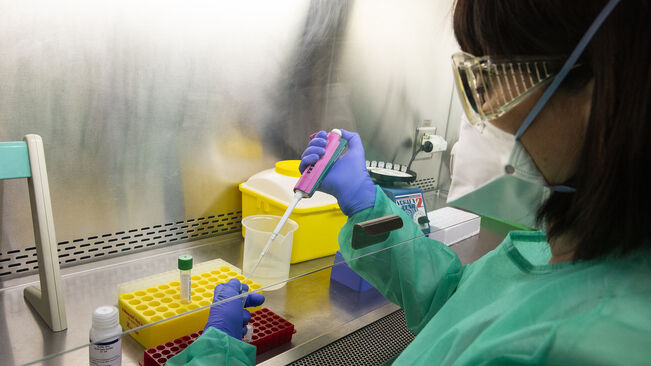 InstitutOstrom's tweet photo. Recordem que els factors subjacents a l'alentiment del #ProgramaOrfeu foren:
🧪 Burocràcia: els escobillons nasals no eren els homologats
👃 Reglamentacions de reserva: un microbiòleg clínic havia de derivar les proves PCR
El problema es repeteix amb tests d'antigen i vacunes https://t.co/Z2yyMEotT9