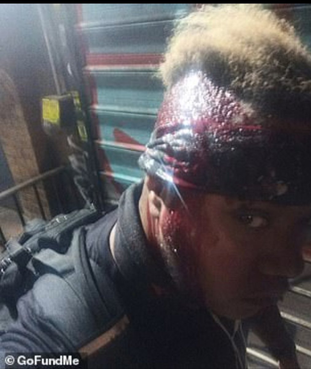 villain_tiny's tweet photo. All these conservatives talking about how Ashli Babbit was vEtErAn. But they didn't give two fucking shits when Marine veteran &amp; hospital worker Rayne Valentine was beaten so badly by cops that he needed 7 staples in his head.

His crime? Leaving work. https://t.co/gOvoqjwRIs