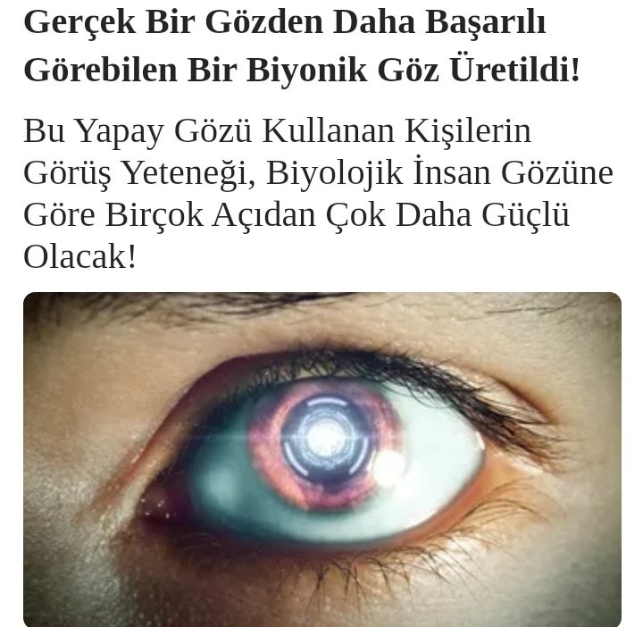 Posthumanizm's tweet photo. Gerçek Gözden daha başarılı görebilen #BiyonikGöz - #YapayGöz üretildi
(#artificialeye #bioniceyes #posthümanizm #transhümanizm) https://t.co/dgjeqbCOCg