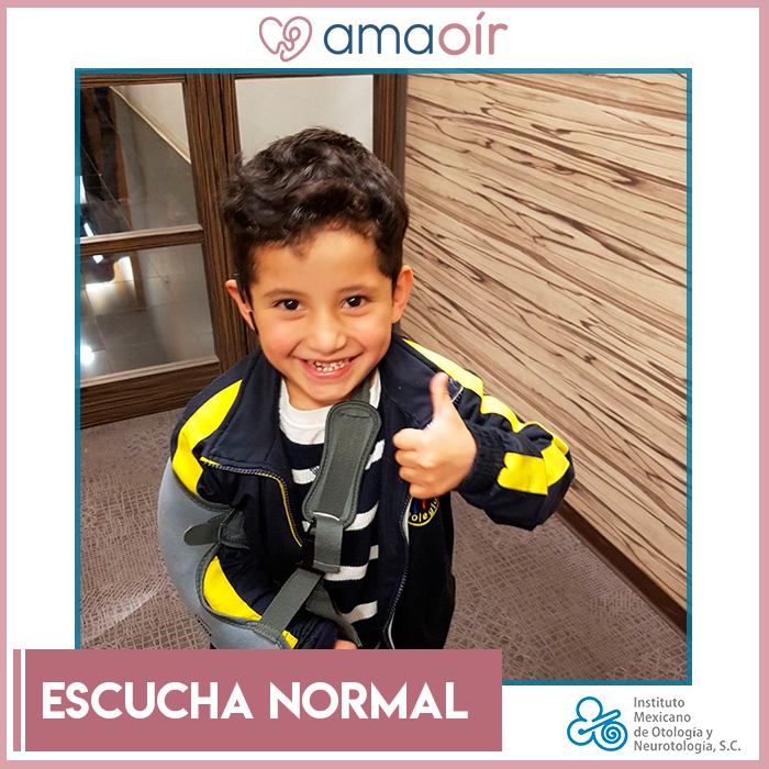 Después de varios meses, los pacientes implantados escuchan normalmente, pueden seguir conversaciones y encajar perfectamente en la sociedad.