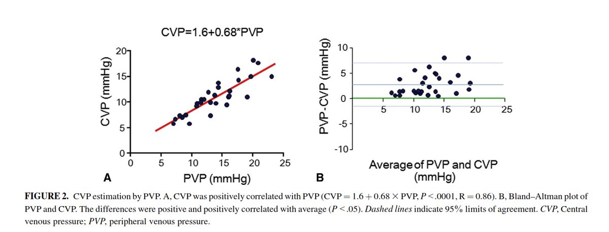 Another study by Masutani et al. evaluated 30 patients post-Fontan (median age 8.6 yrs) and confirmed CVP and PVP were highly correlated (R=0.86, P<.0001). PVP was always > than CVP (otherwise there would be no forward flow). Regression equation:CVP = 1.6 + 0.68 * PVP