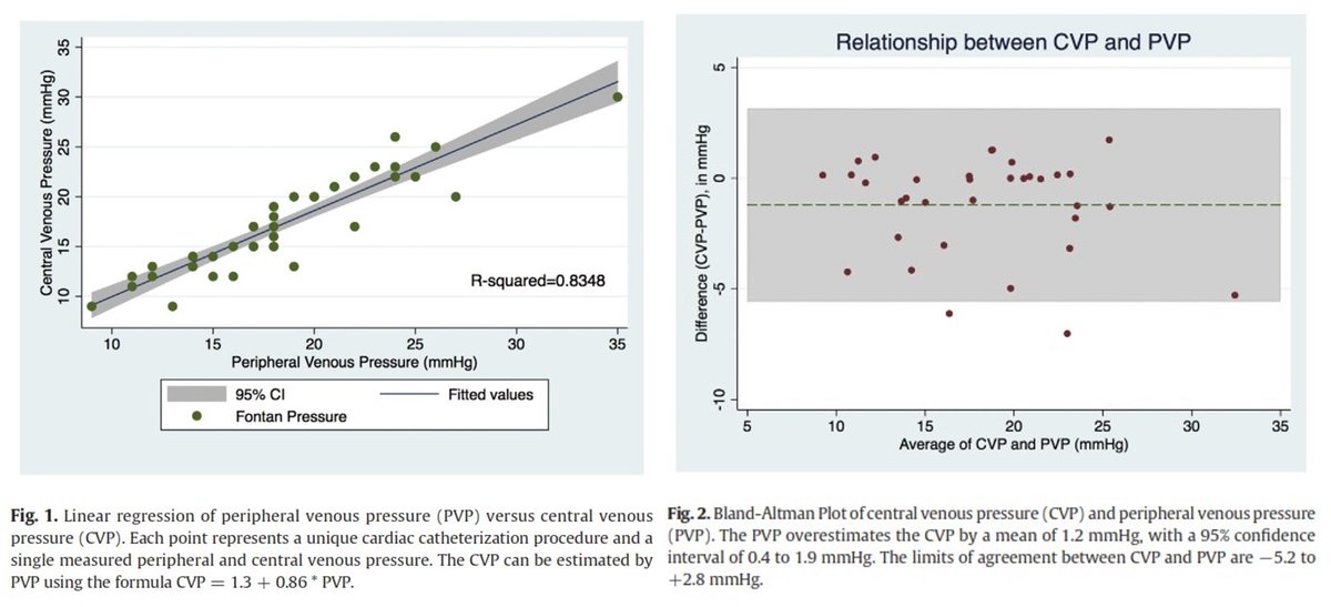 Recently, the ACHD group at UCLA measured PVP and CVP in 38 ADULTS with a Fontan and found that PVP overestimates CVP by a mean of 1.2 mmHg. CVP = 1.3 + 0.86*PVP.  https://doi.org/10.1016/j.ijcard.2020.11.007
