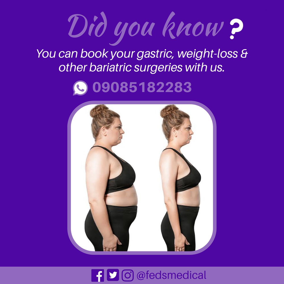 FedsMedical's tweet photo. WEIGHT-LOSS SURGERY YOU CAN TRUST

Book your gastric bypass, weight-loss &amp; other bariatric surgery with us NOW. 

Feds Medical has a network of proven specialists both in Nigeria and overseas. 

Start here 09085182283

WhatsApp • Chat • Voice • Video

#fedsmedical https://t.co/wWnANsSmUw