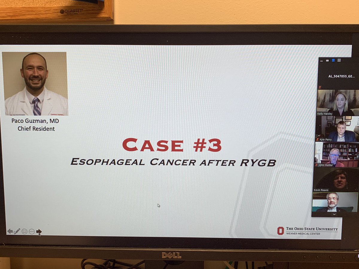 Ohio State Wexner Medical Center Surgery Dept. tweet media