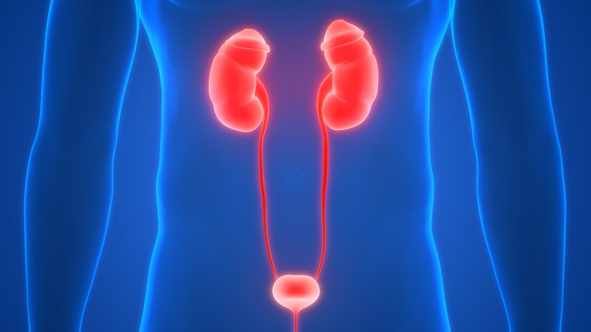 #Highlights du #CCAFU : Chimio-ablation des tumeurs uothéliales de la voie excrétrice urinaire supérieur de bas grade : le traitement conservateur des #TVES va connaître de nouveaux développements dans les prochaines années… urofrance.org/courriels/uro-…