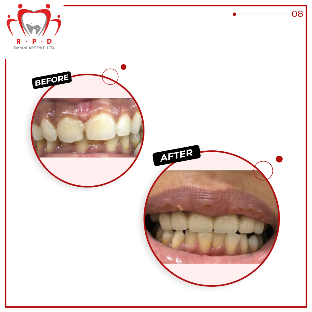 RPDDENTALART's tweet photo. ...(2) 

Here are some successful cases that she's treated with our help. https://t.co/LLmEzpIQG3