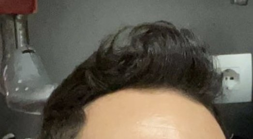 7M for new hair and 10 off target shots every game